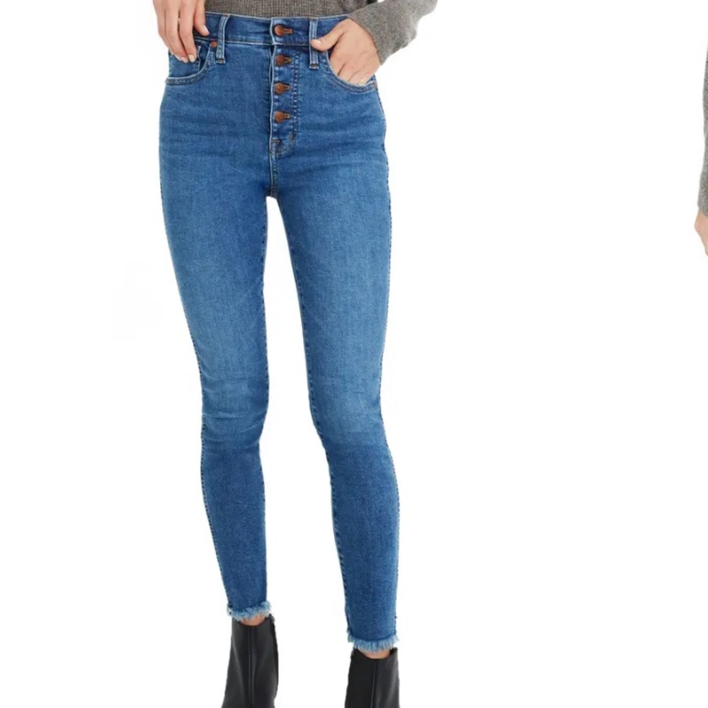 Madewell Button Front Skinny Jeans